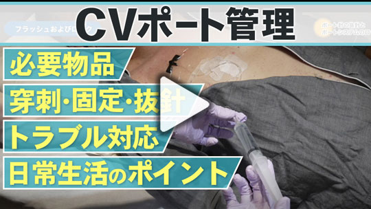 現場で役立つ！ CVポート管理の知識・技術