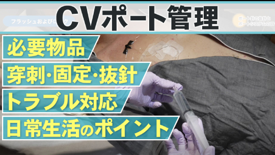 現場で役立つ！ CVポート管理の知識・技術