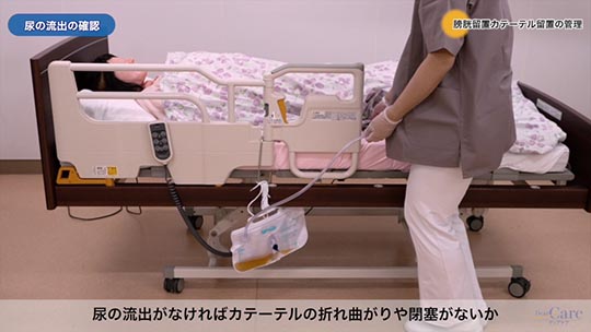 在宅での膀胱留置カテーテル管理