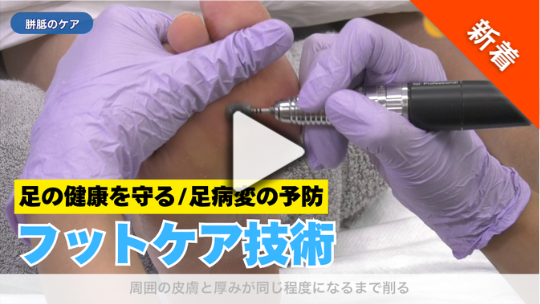 足の健康を守る「フットケア」技術