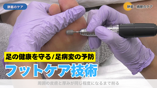 足の健康を守る「フットケア」技術