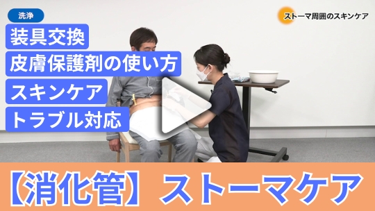 在宅の現場で知っておいてほしい　実践・【消化管】ストーマケア
