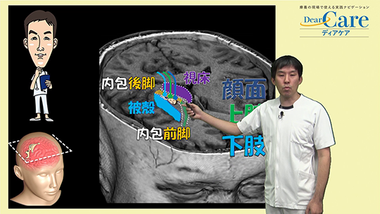 【9月限定・人気セミナー再公開(約67分)】 2．画像でわかる脳のメカニズム（約16分）