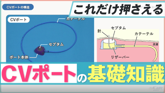 1.CVポートの基礎知識
