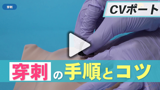 2.ポートの穿刺