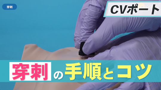 2.ポートの穿刺