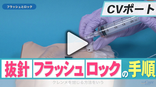 4.ポート針の抜針とポートシステムのロック