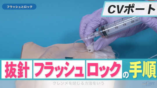 4.ポート針の抜針とポートシステムのロック