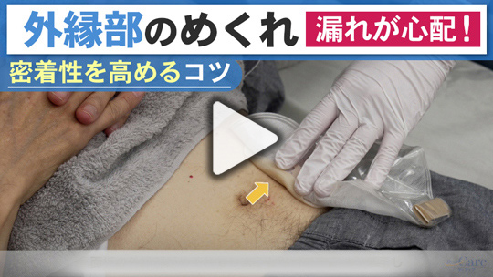 １．面板の外縁部がめくれてしまい、漏れが心配