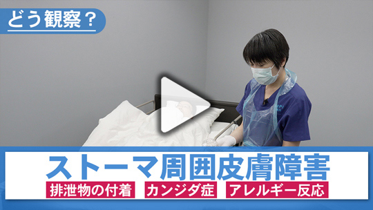 ８．皮膚障害の観察方法は？