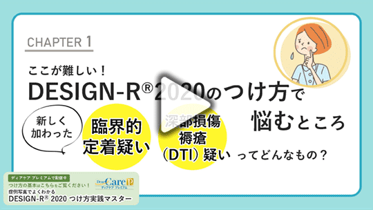 【CHAPTER 1】 ここが難しい!  DESIGN‐R® 2020のつけ方で悩むところ  新しく加わった「臨界的定着疑い」、「深部損傷褥瘡（DTI）疑い」ってどんなもの？