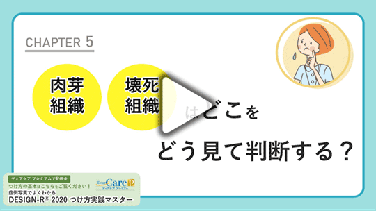 【CHAPTER 5】  「肉芽組織」、「壊死組織」はどこをどう見て判断する?