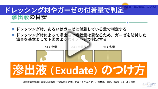 4. 滲出液（Exudate）のつけ方