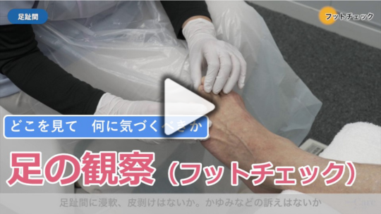 2. 足の観察（フットチェック）