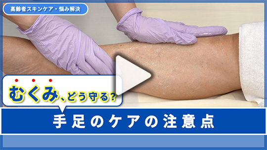 ３.むくみのある手足、どう保護する？　注意点は？ 
