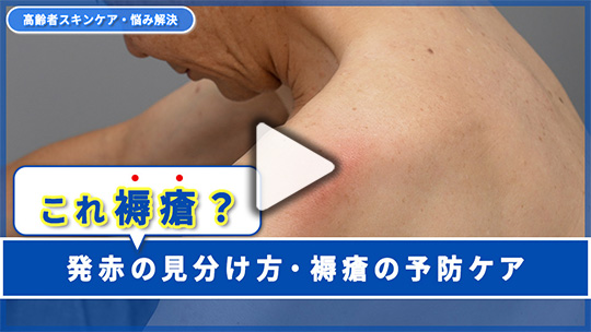 ６.発赤を発見！ これって褥瘡？ どう見分けてケアすればよい？ 