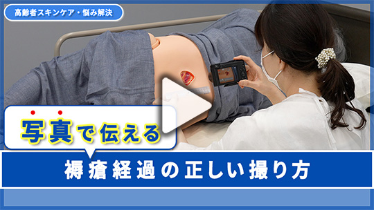７.褥瘡の経過を正確に伝えたい！ 効果的な写真の撮り方は？ 