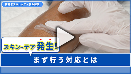 ９.スキン-テアが発生！ どう対処すればよい？ 