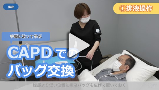 1．CAPDでのバッグ交換の実施手順　 ①排液操作