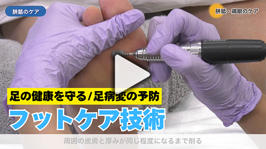 足の健康を守る「フットケア」技術